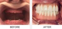 Best Dentist Covina : Elite Care Dental image 3
